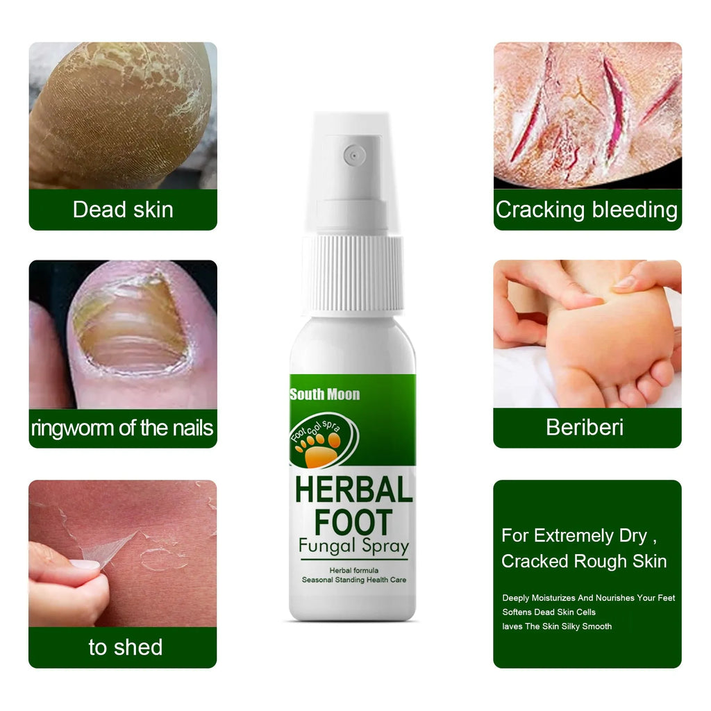 30ml foot nourishing hydrating care spray bottle for foot treatment