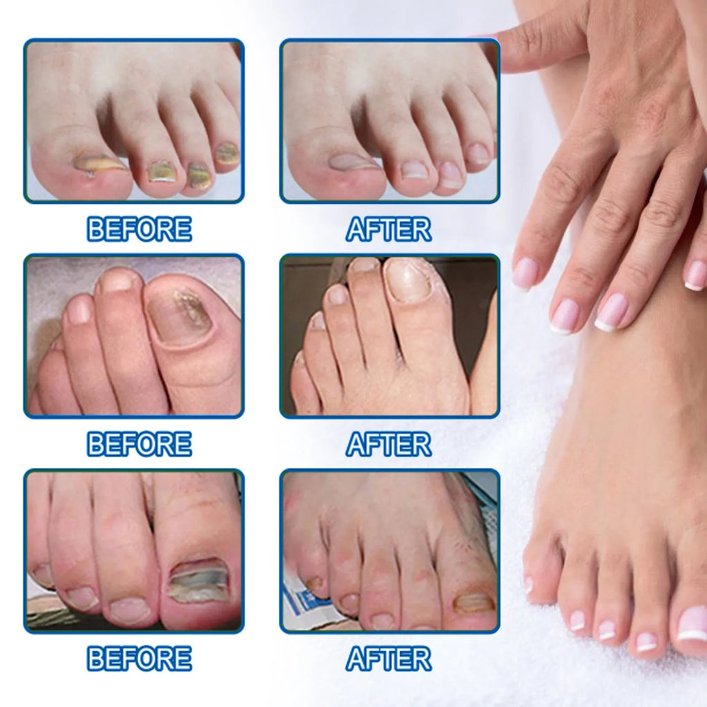Nail repair adhesive bandage nursing patches 32patches box 6.1cm x 3.5cm