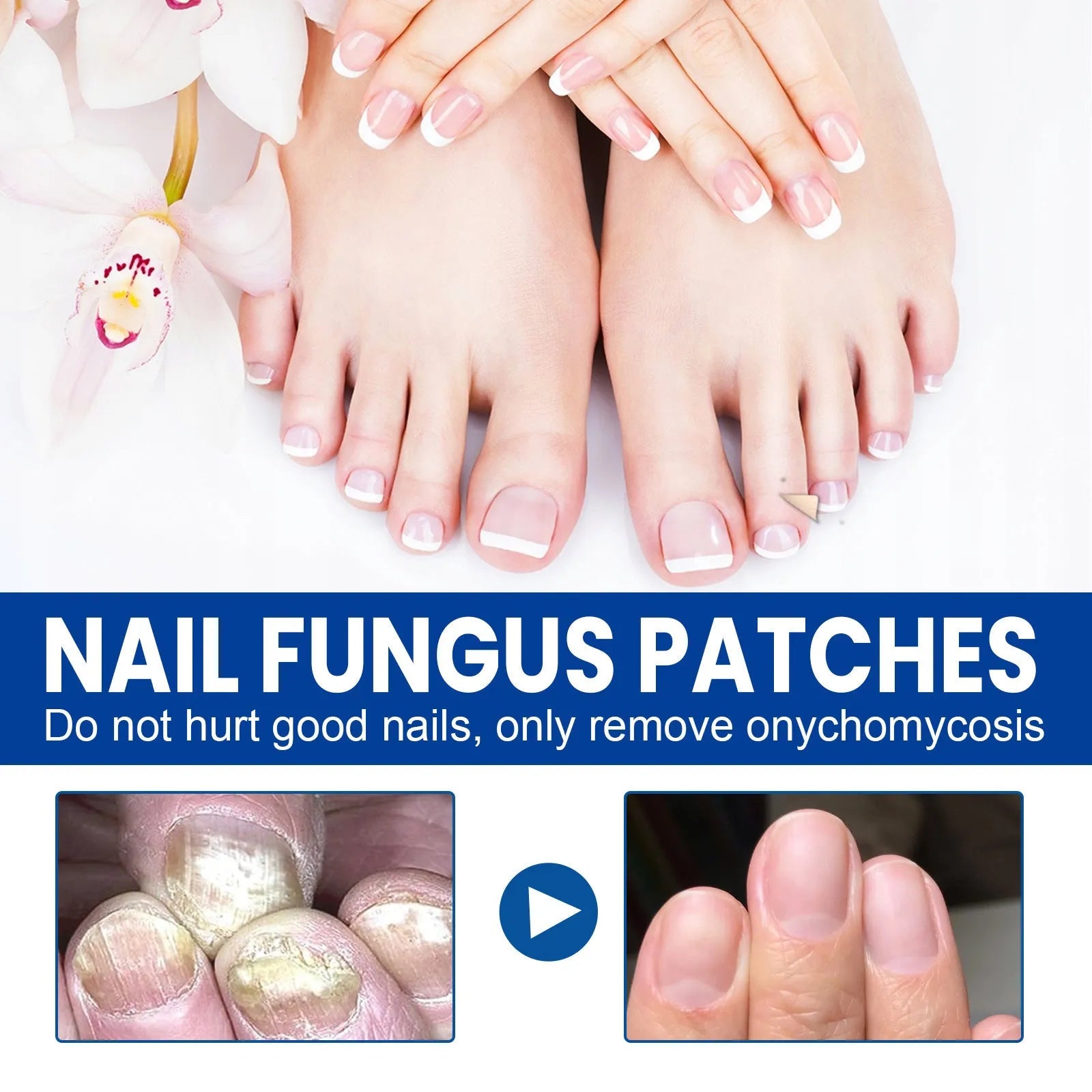 Nail repair adhesive bandage nursing patches 32patches box 6.1cm x 3.5cm