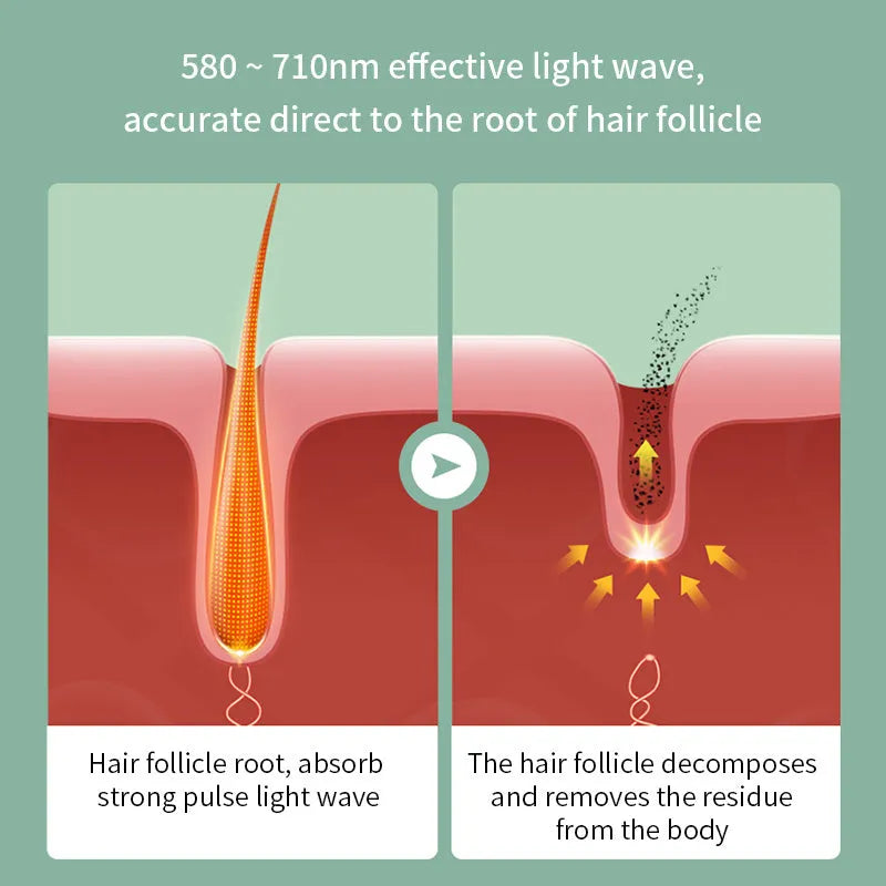 Green IPL painless laser epilator with 590nm wavelength and 500000 flashes for women hair removal