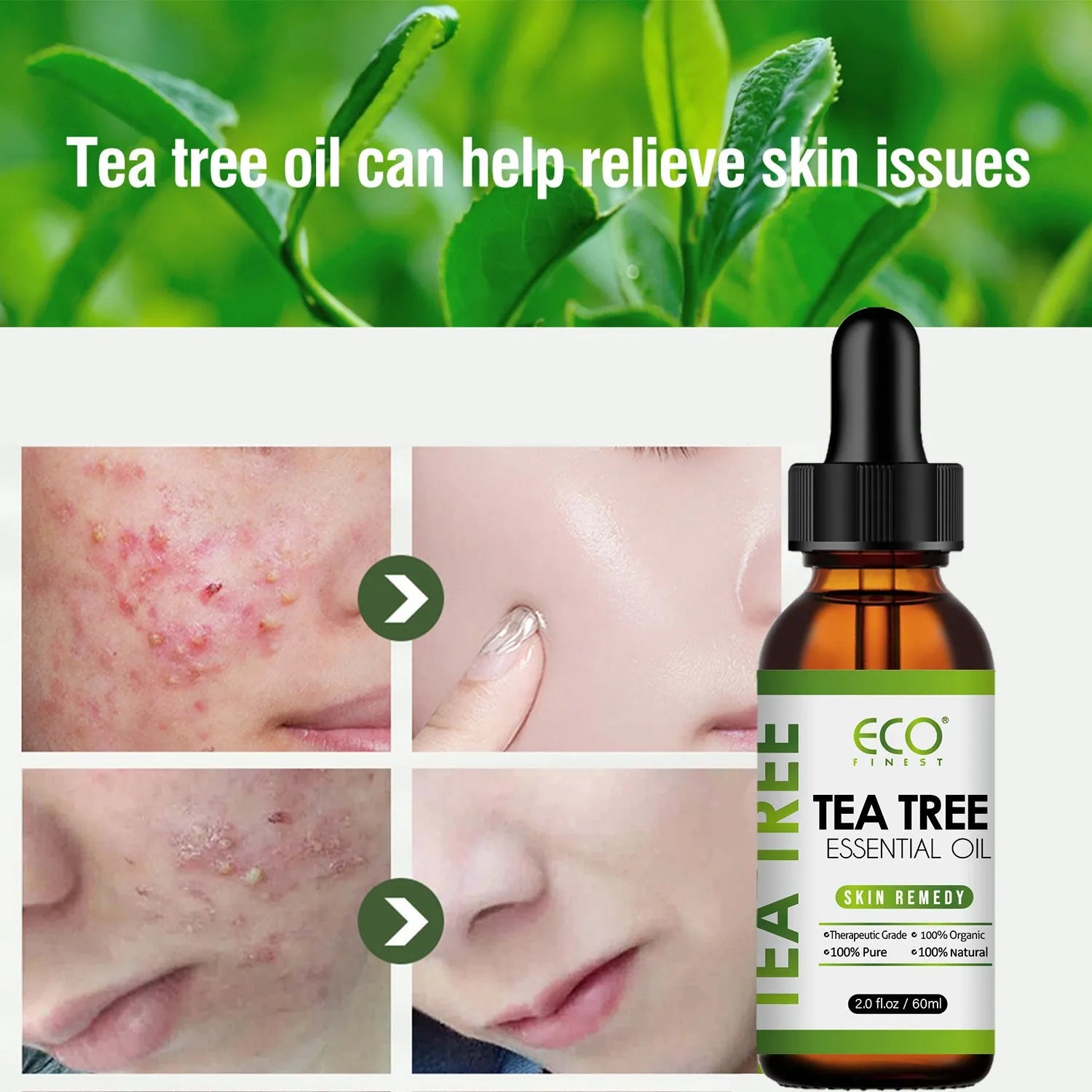 60ml bottle of pure tea tree essential oil for acne treatment and skin care