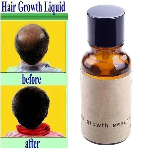 Hair growth liquid 20ml bottle for thicker hair restoration and loss prevention