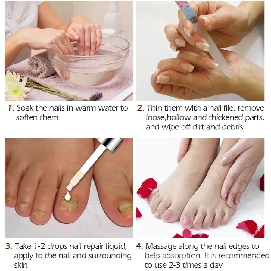 10ml bottle of Repair Dust whitening antibacterial liquid for foot care