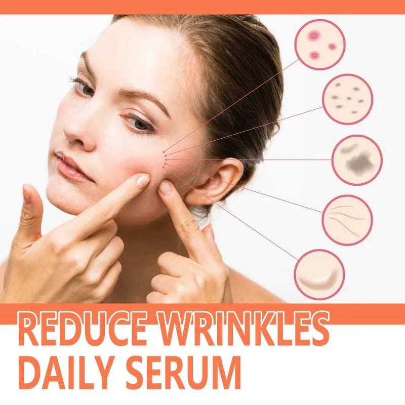 30ml rose essential oil bottle for facial skincare treatment targeting fine wrinkles