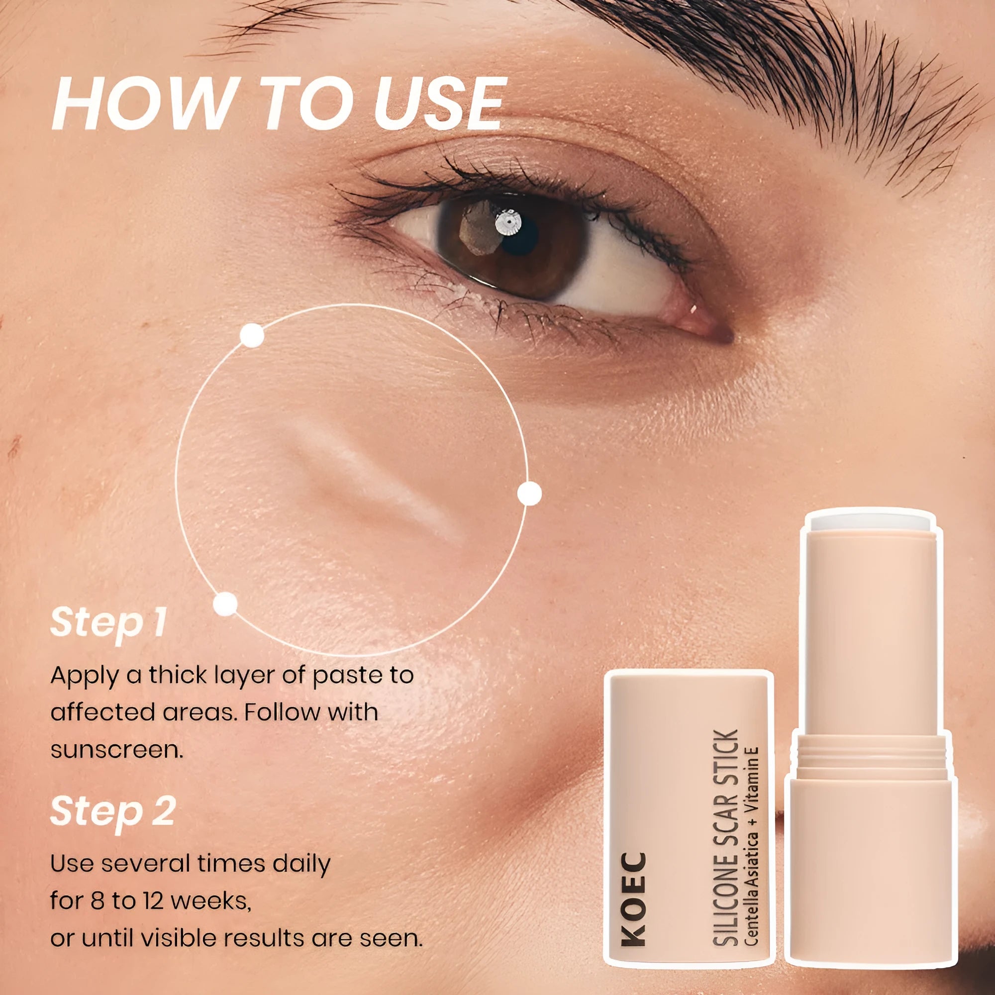 Silicone Scar Stick 7g in compact stick form for scar moisturising and soothing