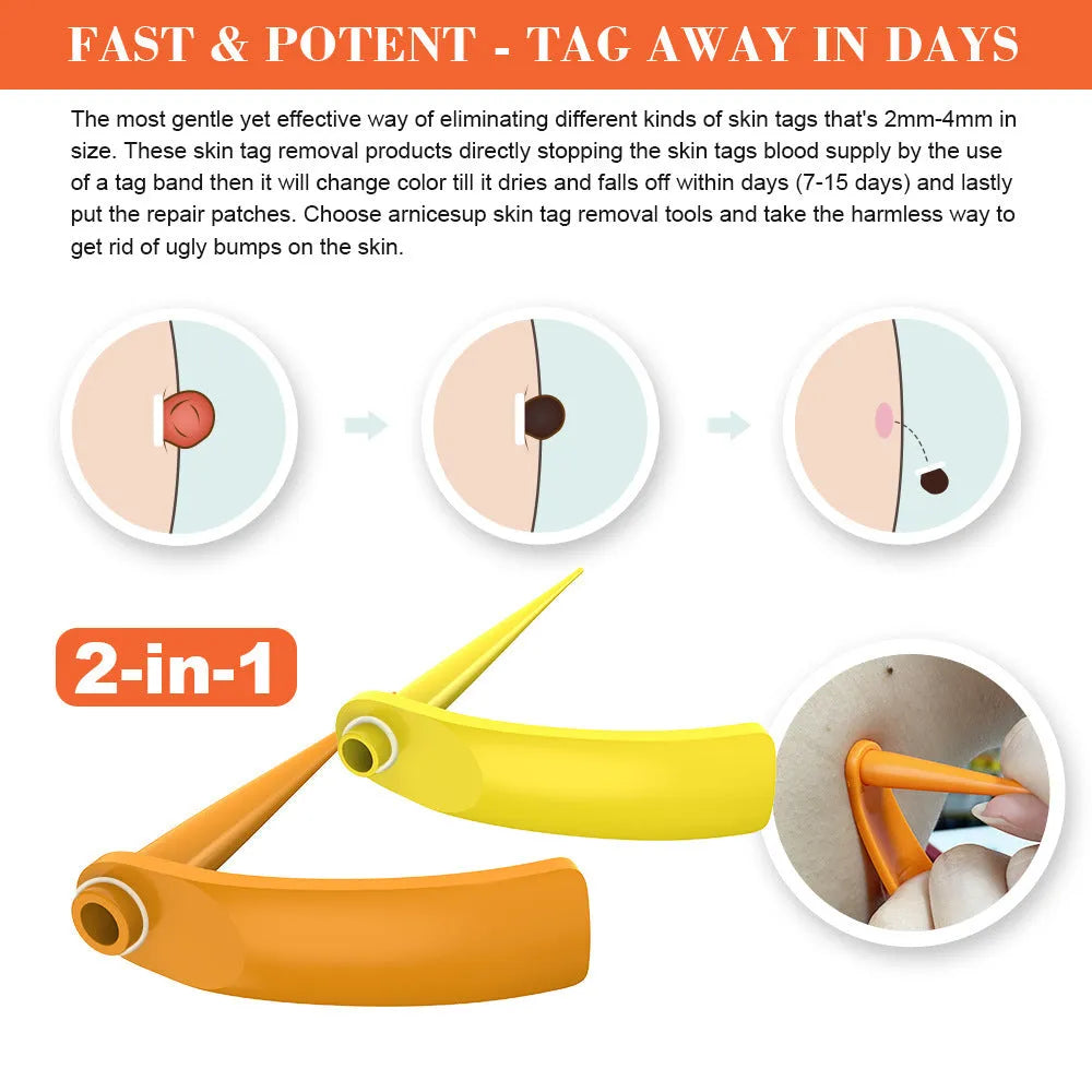 Orange-yellow wart removal tool kit with two handheld devices, rubber rings, alcohol swabs, and a repair sticker.