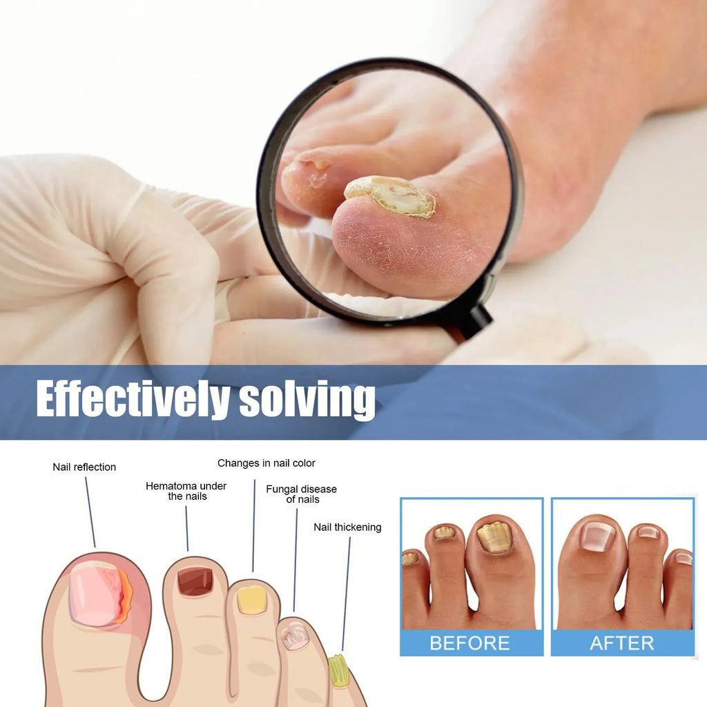 Nail repair adhesive bandage nursing patches 32patches box 6.1cm x 3.5cm
