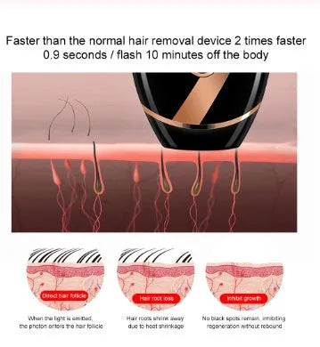 Black beauty laser hair removal machine with IPL technology, ABS body, 14 cm length, for home use on legs and face
