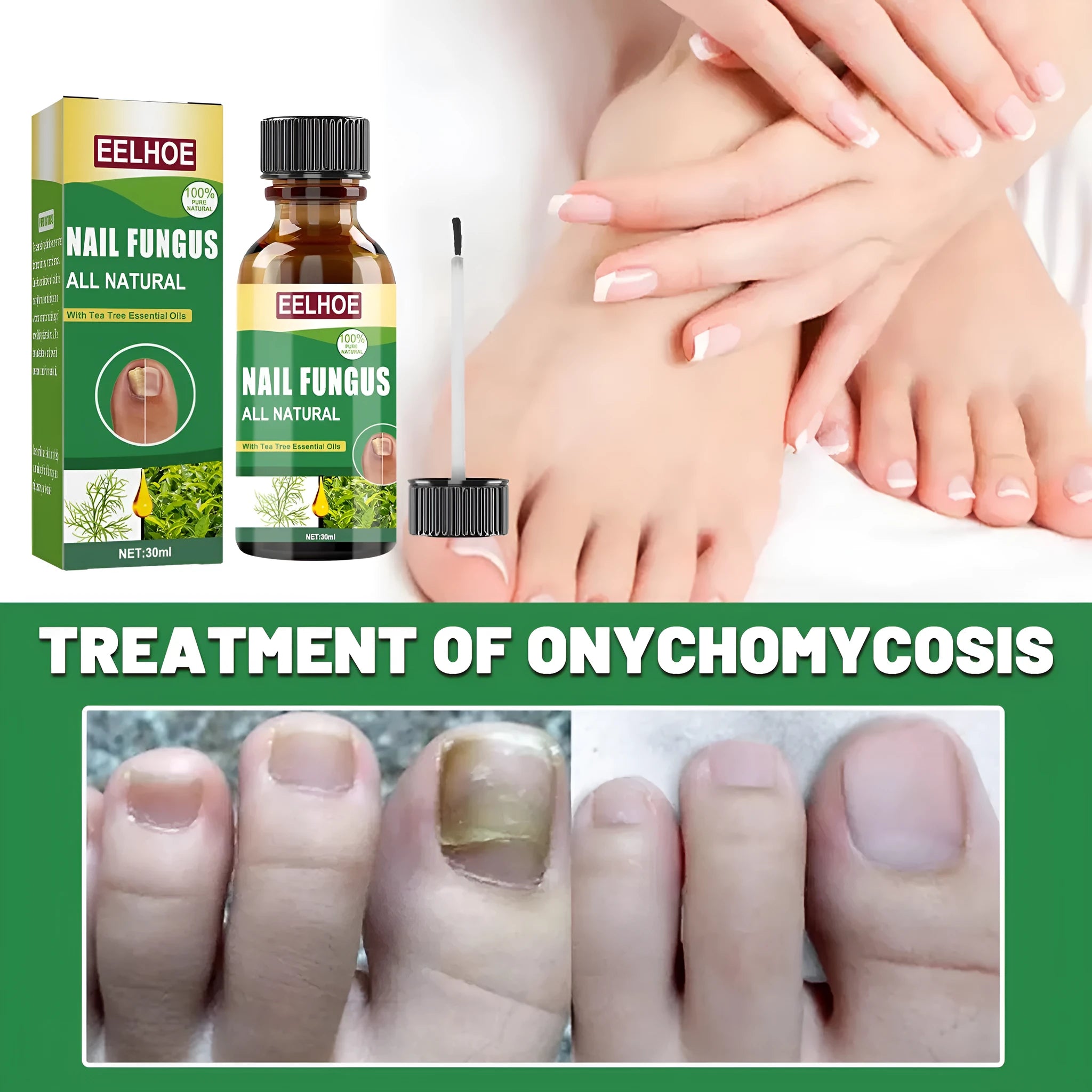 30ml bottle of tea tree oil nail repair fluid for hand and foot nail care