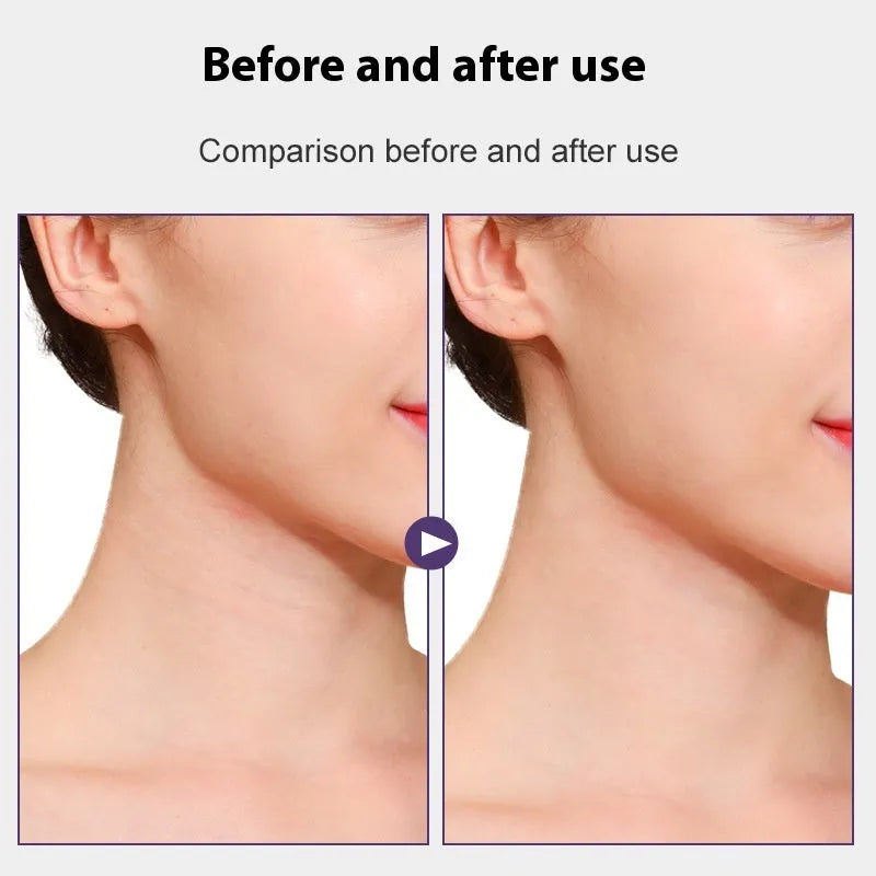 Neck pattern adhesive tape firming sling with skin tone colour and adhesive patches