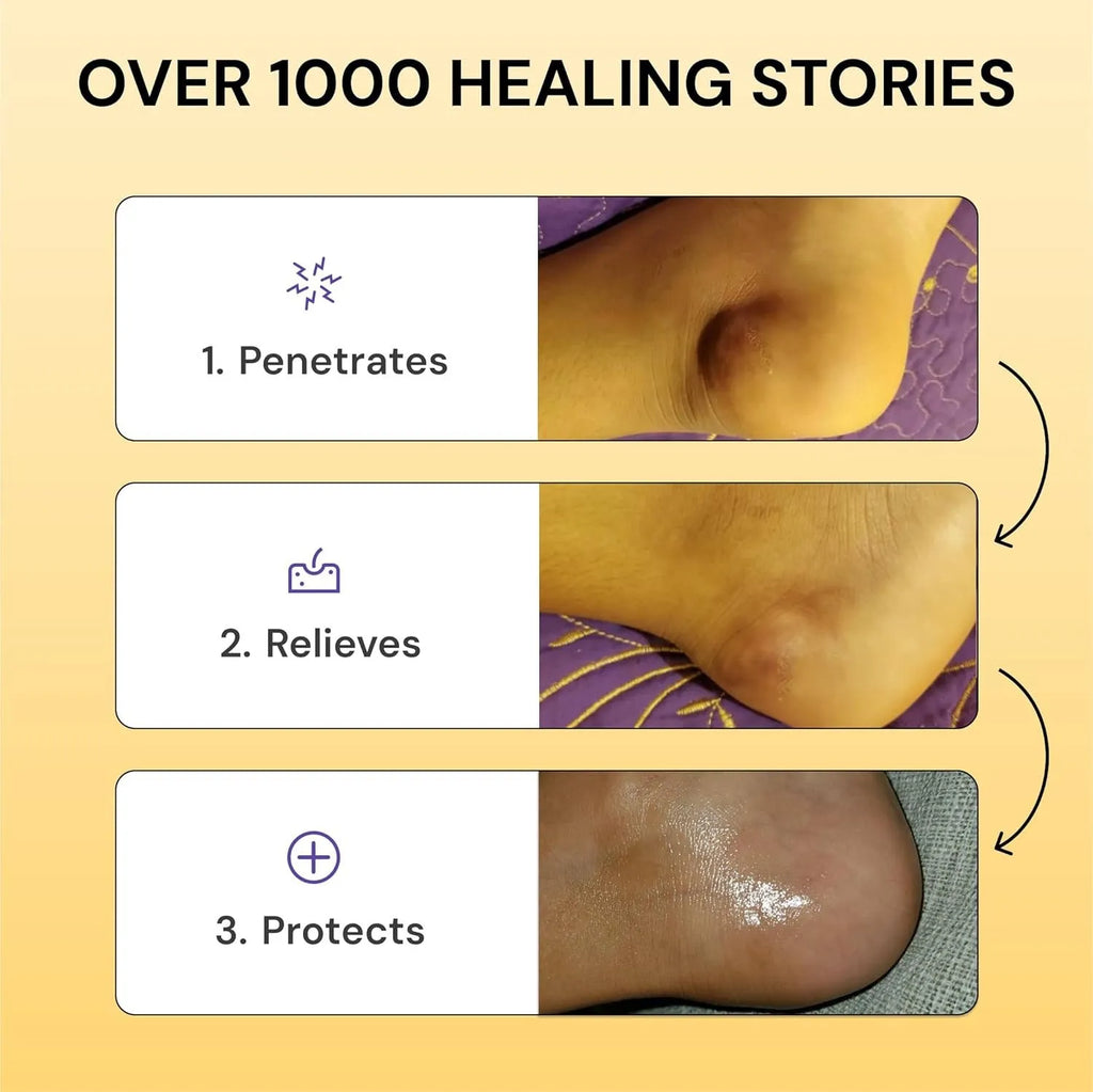 Universal Flare Care pain relief cream tube containing 120g of analgesic ointment for muscle and joint discomfort