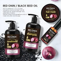 Red onion shampoo and conditioner 4-piece set including 500ml bottles, 250ml hair mask, and 50ml essential oil.